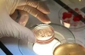 临海台州医院试管婴儿技术：专业实力与孕育希望之选