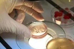 佛山试管婴儿成功率最高医院排名揭晓