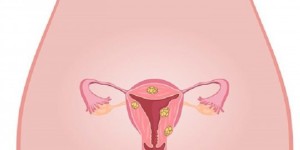 试管会增加卵巢癌症吗 试管婴儿会增加卵巢癌的风险吗