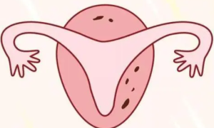 卵巢萎缩能做试管么？卵巢萎缩能生孩子吗？