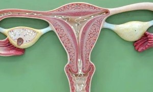 试管怀孕卵巢扭曲如何检查 试管婴儿怀孕后卵巢变大怎么恢复