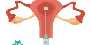 摄图网_306448706_Uterus和胚胎转移人工授精孤立女器官体外授精孕育现代医药注射器和生殖系统外科手术胚胎转移人工授精子宫和卵孤立器官（企业商用）.jpg