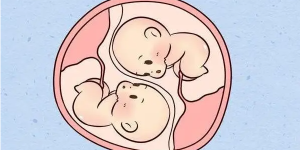你所不知道的试管双胎，从单绒双绒定义了解单胎和双胎的类型！